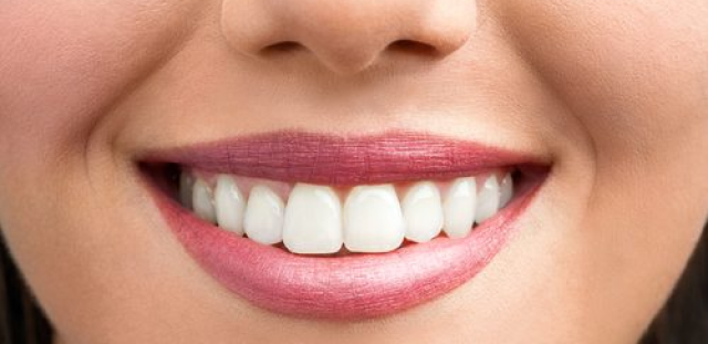 After whitening